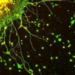neuroni ricreati da cellule staminali