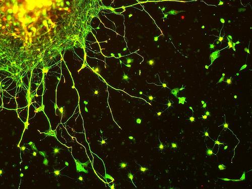 Cervello e invecchiamento: i neuroni non hanno età