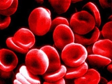 Speranza per la lotta alla leucemia, creato il primo midollo osseo artificiale