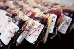 Epatite e Hiv trovati nel sangue dei donatori